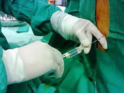 Γονιμότητα: Η «φορητή» επισκληρίδιος βελτιώνει την εμπειρία του τοκετού